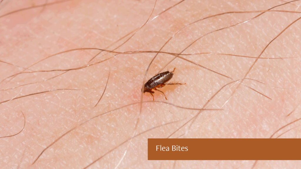 flea bites