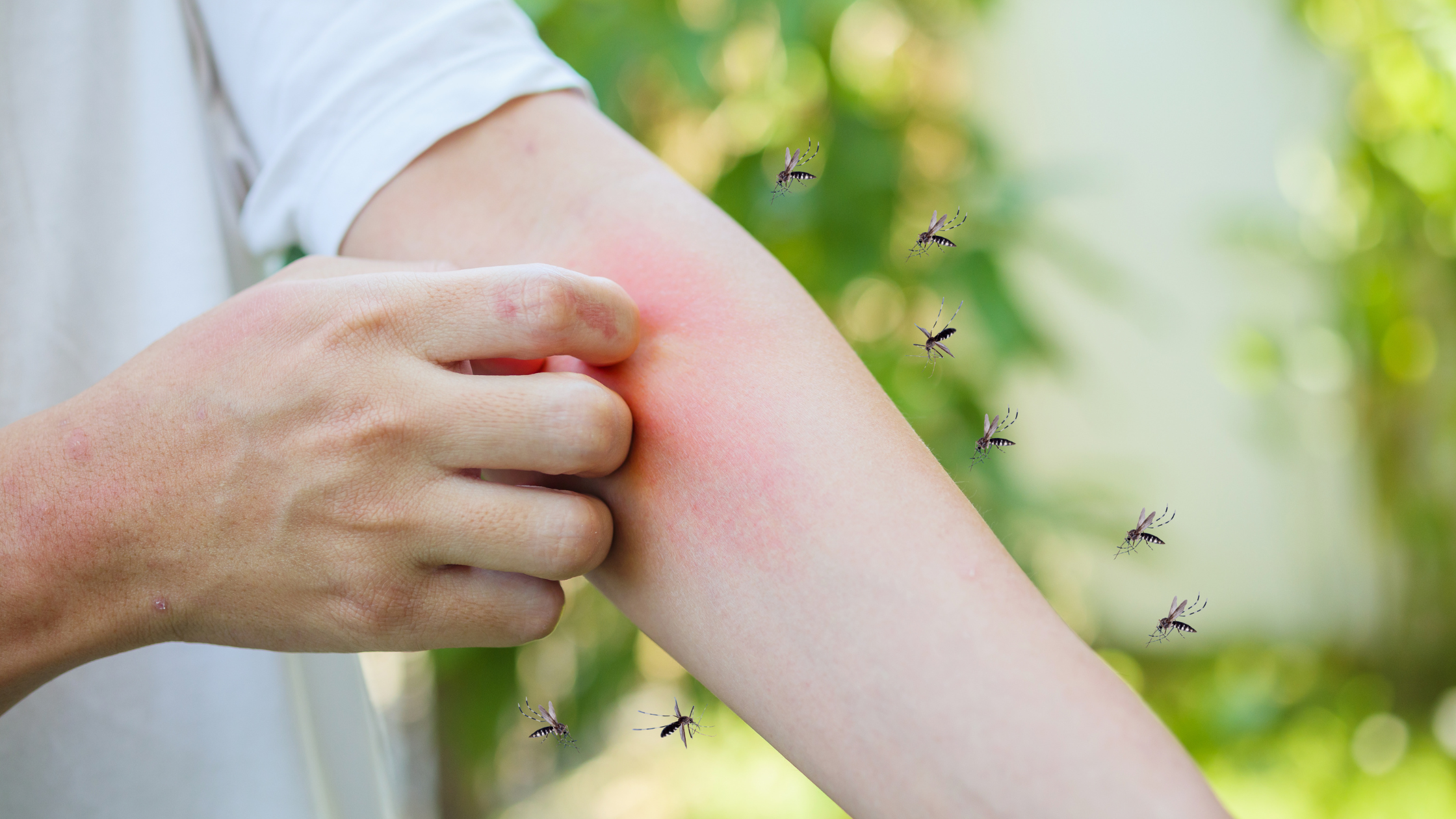 flea bites vs mosquitoes