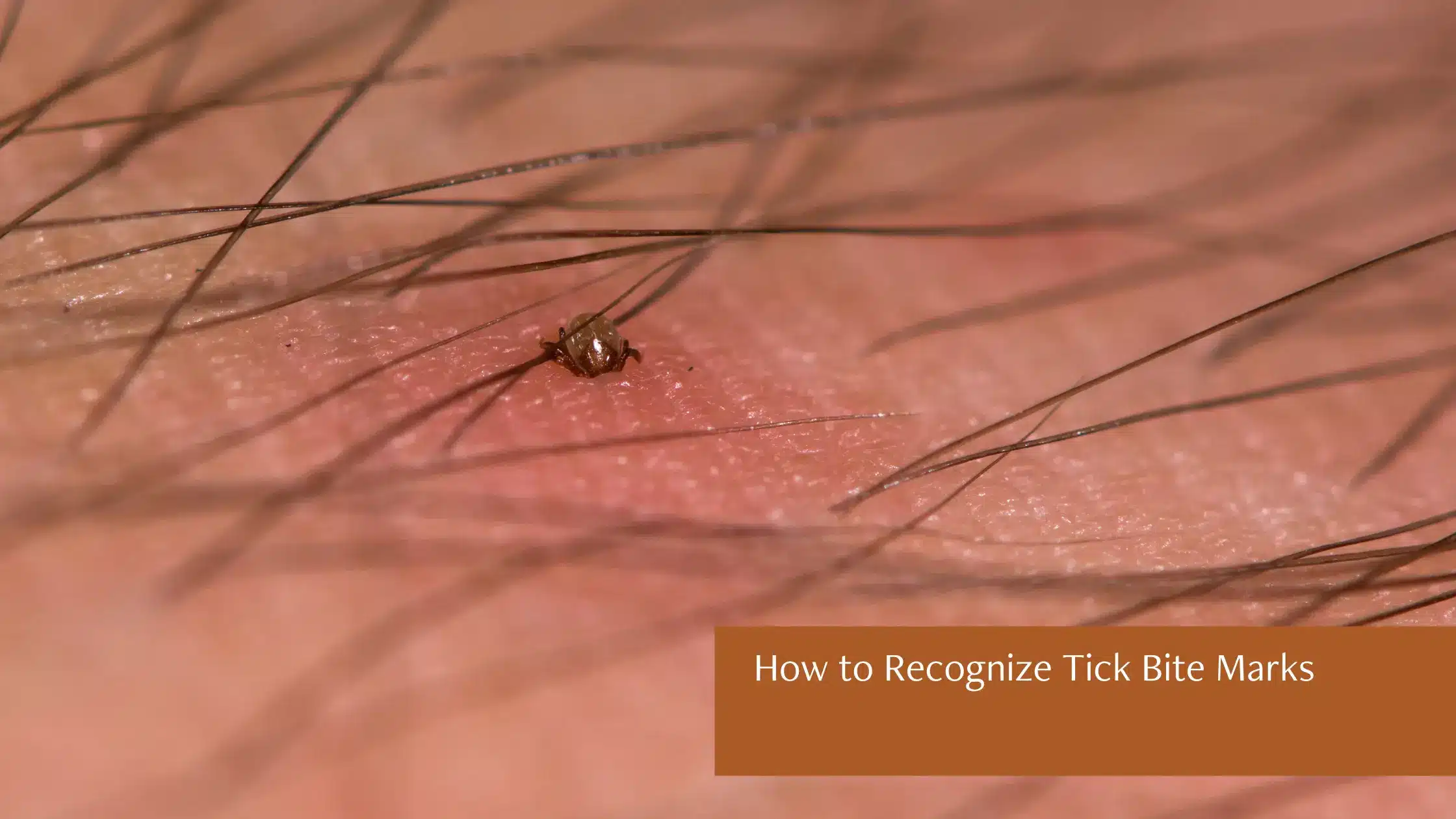 How to Recognize Tick Bite Marks